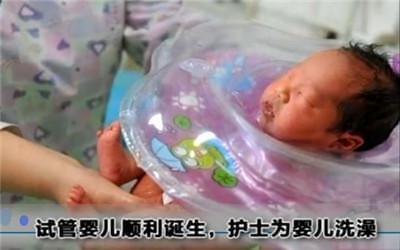 染色体易位案例